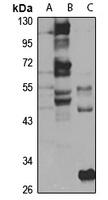 FLVCR2 Rabbit Polyclonal Antibody