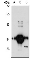 FN3K Rabbit Polyclonal Antibody