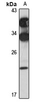 FOPNL Rabbit Polyclonal Antibody