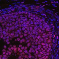 FOXL2 Rabbit Polyclonal Antibody