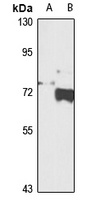Frizzled 7 Rabbit Polyclonal Antibody