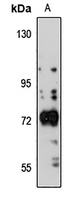 GABRQ Rabbit Polyclonal Antibody