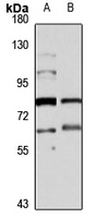 GABRR2 Rabbit Polyclonal Antibody