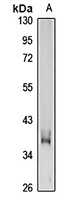 GP6 Rabbit Polyclonal Antibody