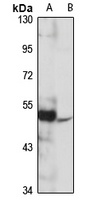 GPER Rabbit Polyclonal Antibody