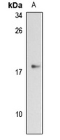GPIHBP1 Rabbit Polyclonal Antibody