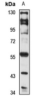 GPR37 Rabbit Polyclonal Antibody