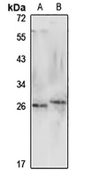 GPX3 Rabbit Polyclonal Antibody