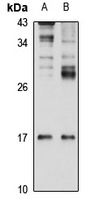 Gremlin-1 Rabbit Polyclonal Antibody