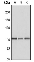 HACE1 Rabbit Polyclonal Antibody