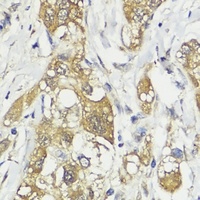 HACE1 Rabbit Polyclonal Antibody