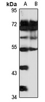 Orexin Receptor 1 Rabbit Polyclonal Antibody