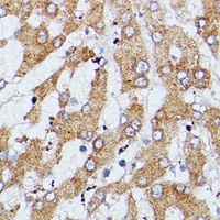 Vigilin Rabbit Polyclonal Antibody