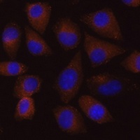 Vigilin Rabbit Polyclonal Antibody
