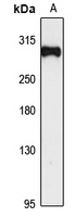 HECTD1 Rabbit Polyclonal Antibody