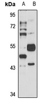 HHLA2 Rabbit Polyclonal Antibody