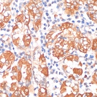 HHLA2 Rabbit Polyclonal Antibody