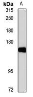 HKDC1 Rabbit Polyclonal Antibody