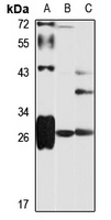 HLA-DRB3 Rabbit Polyclonal Antibody
