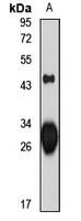 HLA-DRB3 Rabbit Polyclonal Antibody