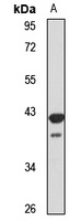 hnRNP A/B Rabbit Polyclonal Antibody