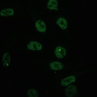 hnRNP A/B Rabbit Polyclonal Antibody