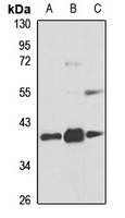 hnRNP D Rabbit Polyclonal Antibody