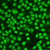 hnRNP D Rabbit Polyclonal Antibody