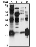 HPCAL4 Rabbit Polyclonal Antibody