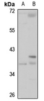 HSD17B1 Rabbit Polyclonal Antibody