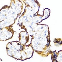 HSD17B1 Rabbit Polyclonal Antibody