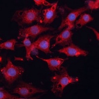 HSD17B1 Rabbit Polyclonal Antibody