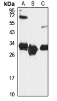 HSD17B8 Rabbit Polyclonal Antibody