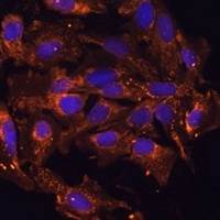 HSD17B8 Rabbit Polyclonal Antibody