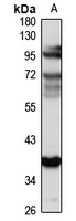 ICA69 Rabbit Polyclonal Antibody