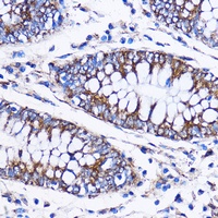 ICA69 Rabbit Polyclonal Antibody