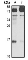 IEX1 Rabbit Polyclonal Antibody
