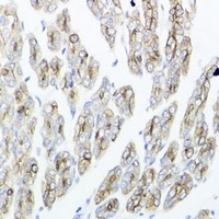 IEX1 Rabbit Polyclonal Antibody