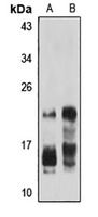IFN alpha 8 Rabbit Polyclonal Antibody