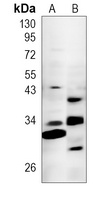 IGFBP6 Rabbit Polyclonal Antibody
