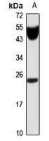 IL-11 Rabbit Polyclonal Antibody