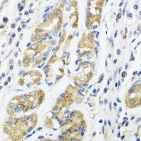 IL-11 Rabbit Polyclonal Antibody