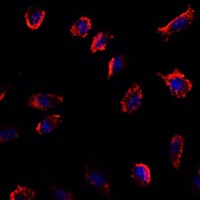 IL-11 Rabbit Polyclonal Antibody