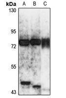IL-17RE Rabbit Polyclonal Antibody