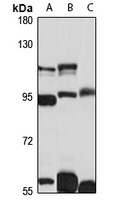 IL1RAPL1 Rabbit Polyclonal Antibody
