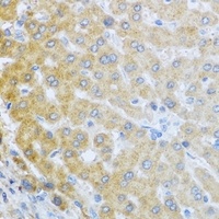 IL-20 Rabbit Polyclonal Antibody