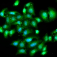 IL-20 Rabbit Polyclonal Antibody