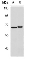 IL-22R Rabbit Polyclonal Antibody
