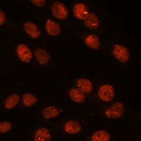 RanBP8 Rabbit Polyclonal Antibody