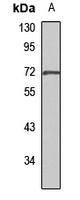 Emt Rabbit Polyclonal Antibody